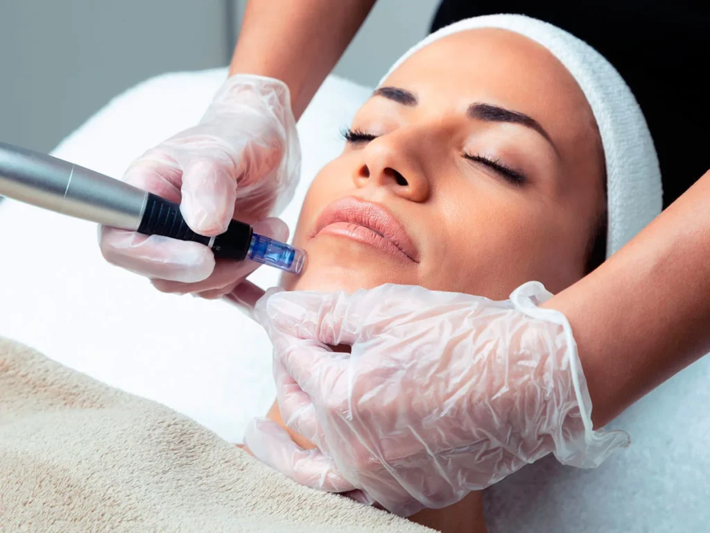 Dermapen