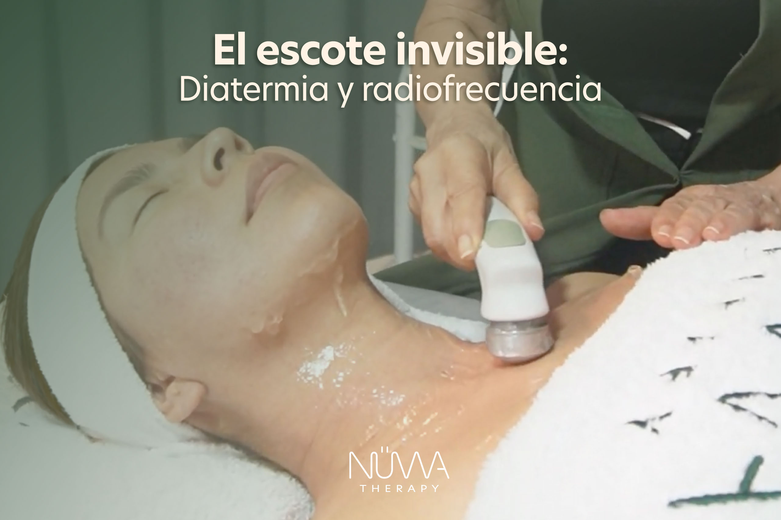 Lee más sobre el artículo El escote invisible: Diatermia, radiofrecuencia