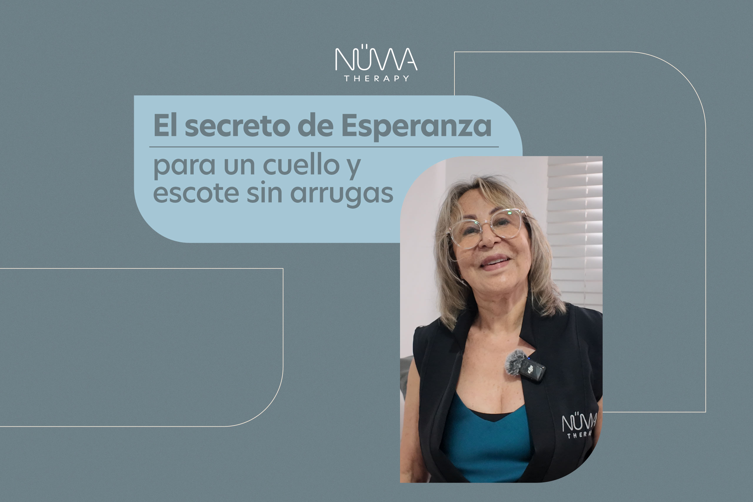 Lee más sobre el artículo El secreto de Esperanza para un cuello y escote sin arrugas
